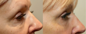 Lencana Medical Laser