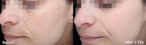 Lencana medical