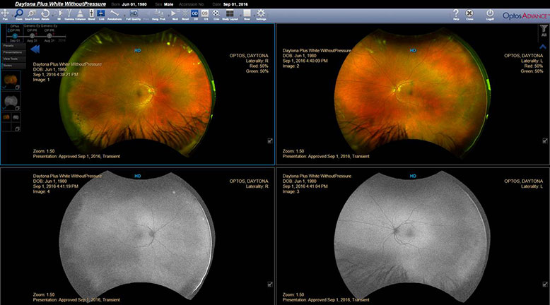 Optos Daytona Retinal Imaging Device - Image 4