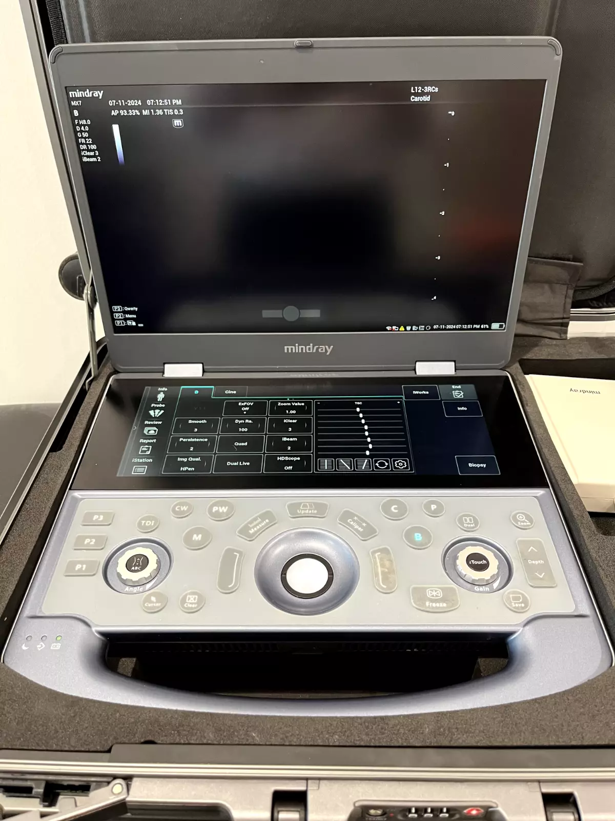 Mindray MX7 Portable Ultrasound Machine - Image 2